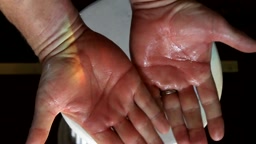 Penance 3 c – strapping the hand up close